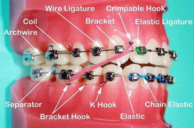 Embrace a Confident Smile: How Orthodontic Treatment Transforms Lives | MODERN ORAL AND DENTAL CLINIC | Tenduni, Bikramganj, Rohtas
