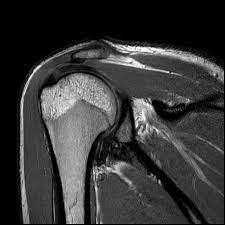 Unlocking Relief: How Musculoskeletal MRI Transforms Lives
