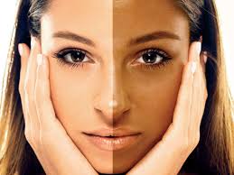 Embrace Radiant Skin: How D-Tan Treatment Transformed Priya’s Confidence | Himani Lalwani