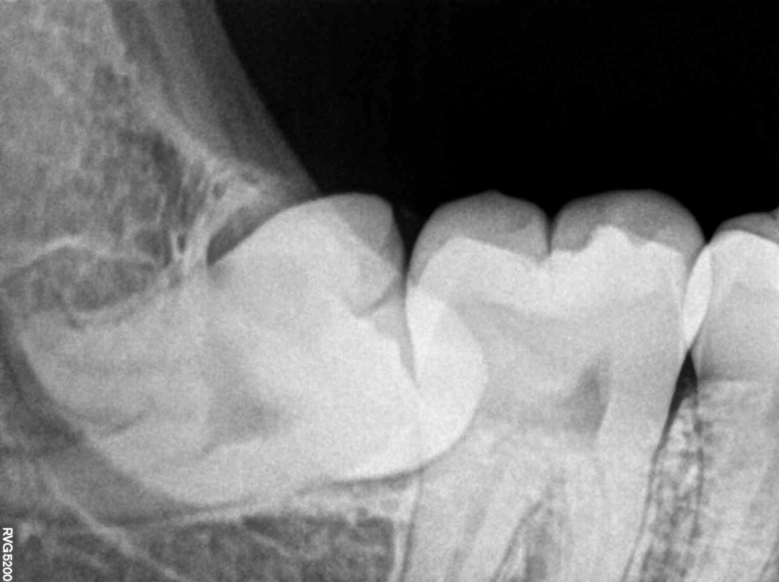 How Modern X-Ray Services Transform Dental Health for Indian Families | MODERN ORAL AND DENTAL CLINIC