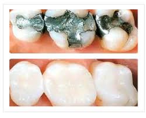 Restoring Smiles: How Modern Oral and Dental Clinics Transform Lives | MODERN ORAL AND DENTAL CLINIC