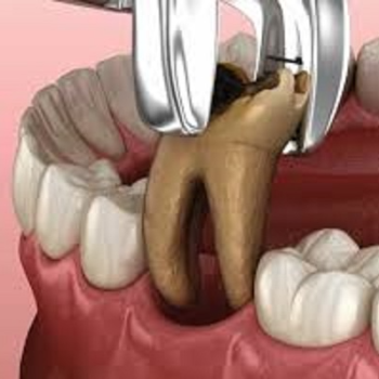 Best Dental Clinic in Bikramganj, Bihar – Your Smile Deserves Expert Care