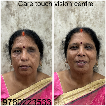 Artificial eye-https://media.vyaparify.com/vcards/products/174026/product_1743141164_67e6392ca4a4e.png Image