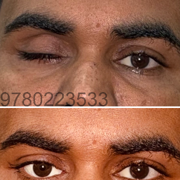 Artificial eye-https://media.vyaparify.com/vcards/products/174027/product_1743141164_67e6392cc34ed.png Image