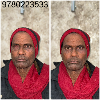 Artificial eye-https://media.vyaparify.com/vcards/products/174028/product_1743141164_67e6392cdee06.png Image