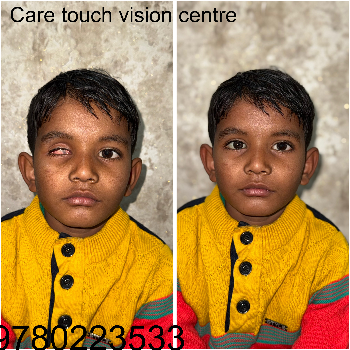 Artificial eye-https://media.vyaparify.com/vcards/products/174031/product_1743141165_67e6392d42977.png Image