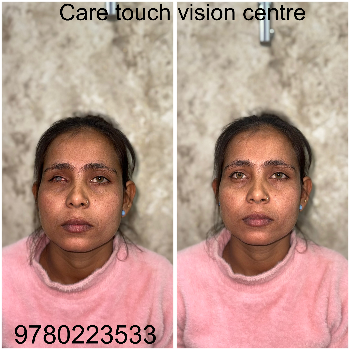 Artificial eye-https://media.vyaparify.com/vcards/products/174032/product_1743141165_67e6392d653e4.png Image