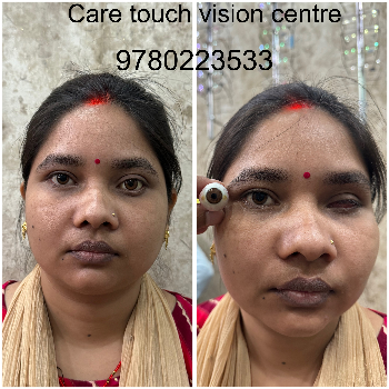 Artificial eye-https://media.vyaparify.com/vcards/products/174035/product_1743141165_67e6392ddbb30.png Image