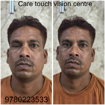 Artificial eye-https://media.vyaparify.com/vcards/products/174038/product_1743141166_67e6392e39085.png Image