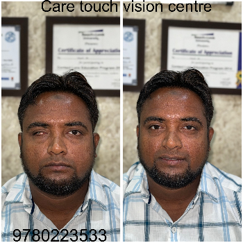Artificial eye-https://media.vyaparify.com/vcards/products/174040/product_1743141166_67e6392e6d9c3.png Image
