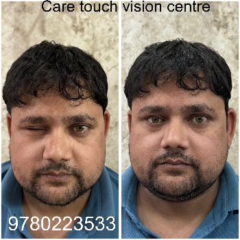 Artificial eye-https://media.vyaparify.com/vcards/products/174041/product_1743141166_67e6392e85f56.png Image
