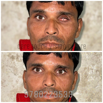 Artificial eye-https://media.vyaparify.com/vcards/products/174042/product_1743141166_67e6392ea2106.png Image