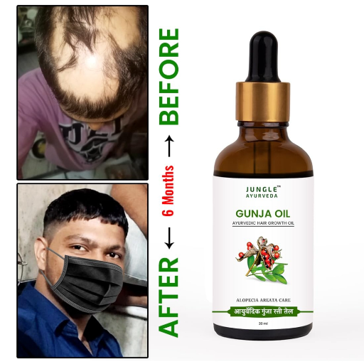 Gunja oil for hair regrowth and alopecia areata-https://media.vyaparify.com/vcards/products/343655/product_1757162812_68bc2d3c01937.png Image