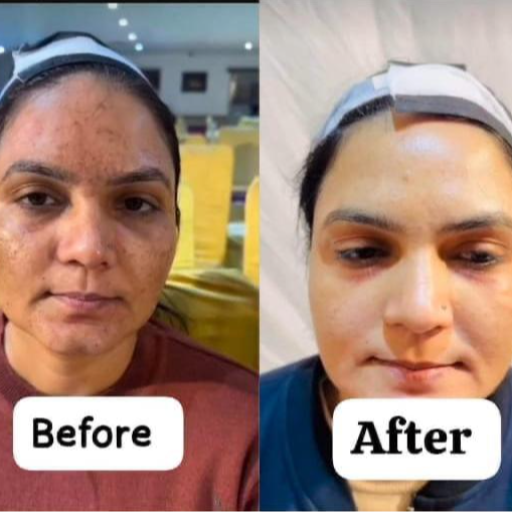 Skin treatment-https://media.vyaparify.com/vcards/products/367809/product_1759216759_68db847749b2b.png Image