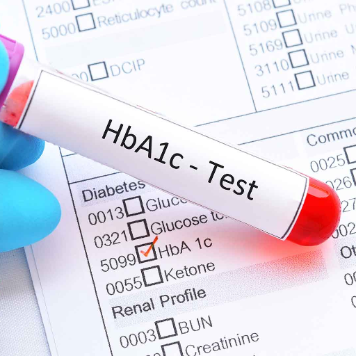 HBA1C BLOOD TEST-https://media.vyaparify.com/vcards/products/370465/product_1759506897_68dff1d1cc4f0.png Image