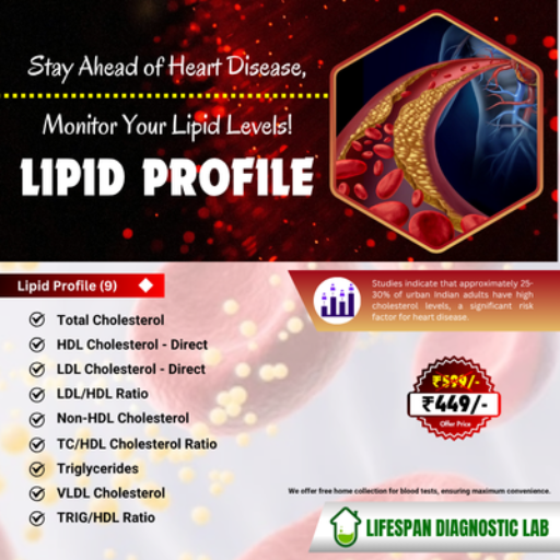 Lipid Profile-https://media.vyaparify.com/vcards/products/381827/product_1760372601_68ed27798e3a1.png Image
