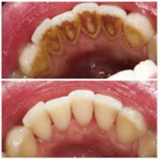 TEETH CLEANING-https://media.vyaparify.com/vcards/products/402453/product_1762416344_690c56d80bf48.png Image