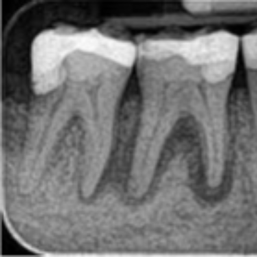 ROOT CANAL TREATMENT-https://media.vyaparify.com/vcards/products/402508/product_1762417743_690c5c4f3d93e.png Image
