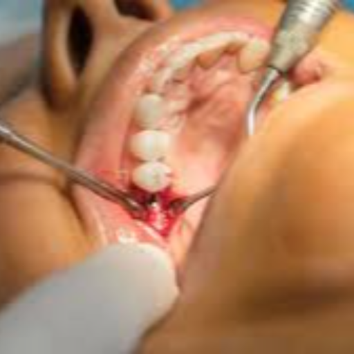  DENTAL SURGERY EKVIRA DENTAL CLINIC AND IMPLANT CENTRE SHOP NO 2  HEMPRABHA APT  SUDARSHAN COLONY EVIRA DENTAL CLINIC AND IMPLANT CENTER THANE EASTLANDMARK Thane East