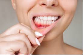  Oral Health: Gum Diseases in Navi Mumbai - Promotes Oral Health GUPTA HIMANSHU BALKUMAR PLOT NO 226 ANAND SHILP NEAR GANESH MANDIR N 3 CIDCO  MANDIR N 3 CIDCO