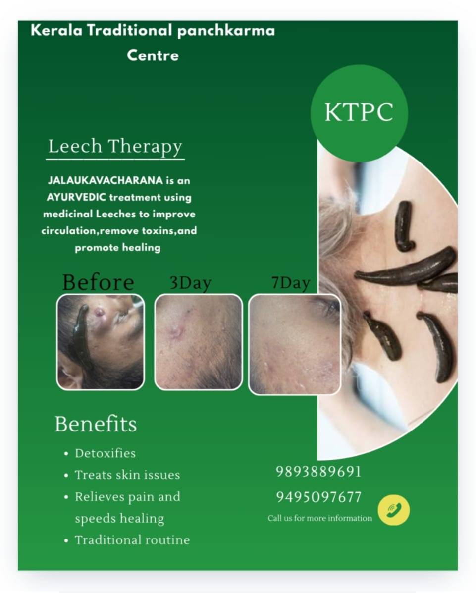  Ayurvedic Leech Therapy in Bhopal: Improve Circulation and Promote Healing KERALA TRADITIONAL PANCHKARMA CENTRE Kerala Traditional Panchkarma Centre, 329 Durgesh Vihar, Opposite Kids Paradise Play School, JK Road, Bhopal