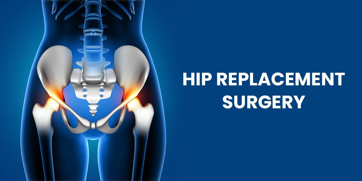  Hip Replacement Surgery DR DAGLIAS SAMBHAV CLINIC 576 4 M G ROAD OPP  TI MALL BEHIND  PREMSHAN TIVILLA BUILDINGLANDMARK Behind Kalyan Jewellers MG Road