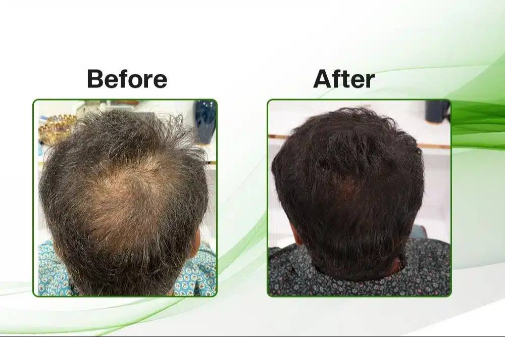 Outdoor Backpack GFC in Agra: Versatile and Durable-https://media.vyaparify.com/vcards/products/489256/product_1768634797_696b39adb7511.png Image