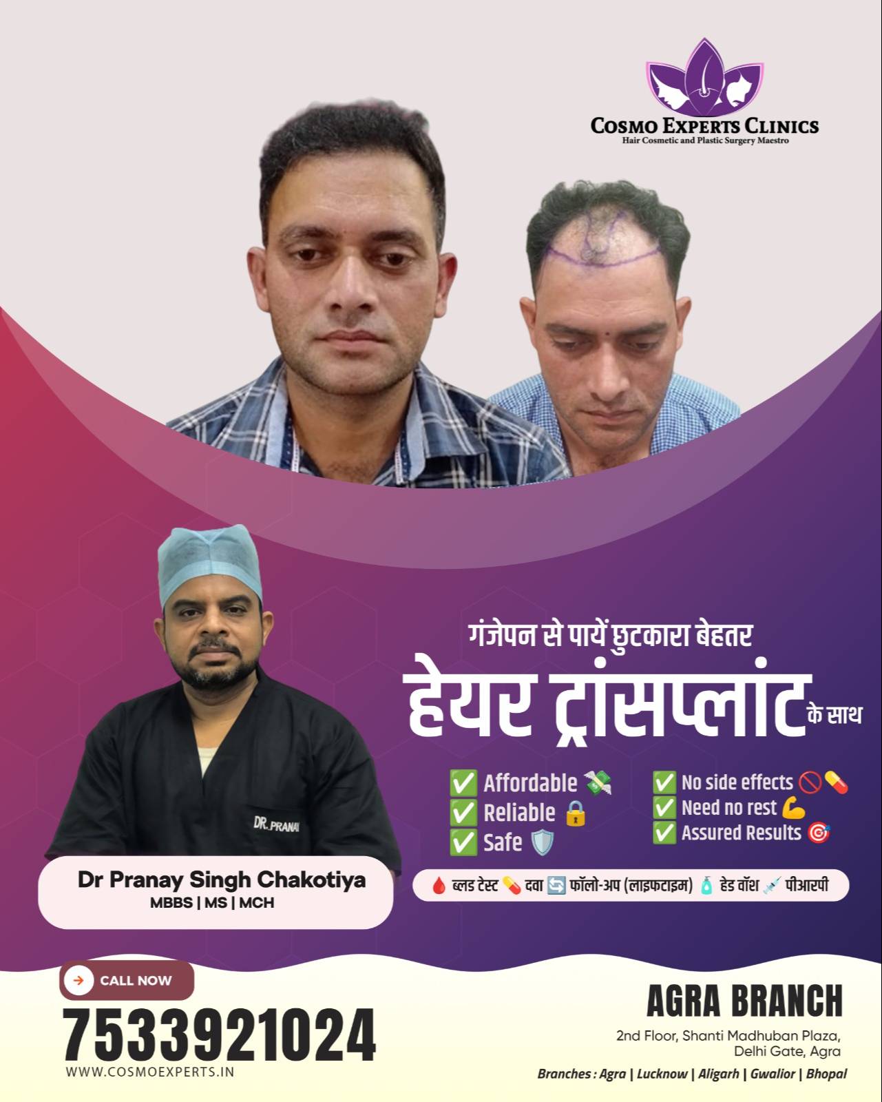 Hair Transplant Procedure in Agra: Experience Natural Hair Regrowth -  - Buy Online at COSMO EXPERTS CLINICS PRIVATE LIMITED