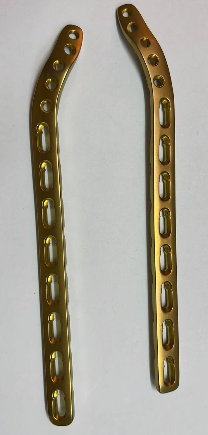  Orthopedic Surgery: Entrolatral Locking Plate in Tyagi House - Secure Fixation AXN ORTHO Tyagi House  Koushik Enclave  Gali No 11 LANDMARK Mandir Wali Gali