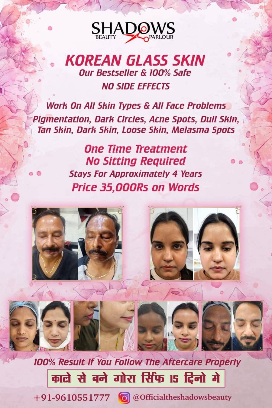 Beauty/Korean Glass Skin Treatment in Beawar: Achieve Flawless Skin -  - Buy Online at SHREE ENTERPRISES
