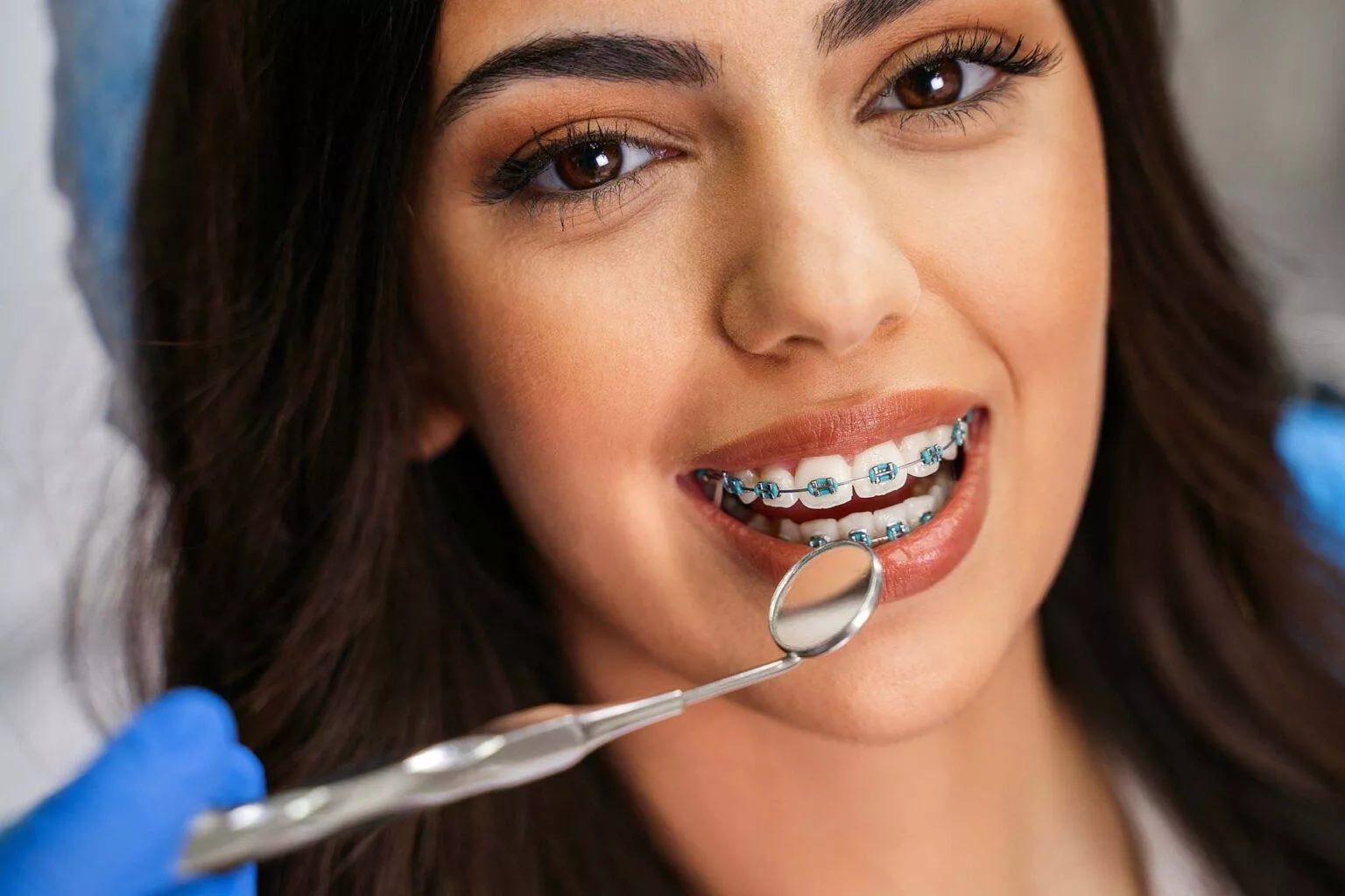 Orthodontic Consult - Braces in Lucknow - Dental Treatment - Image 1