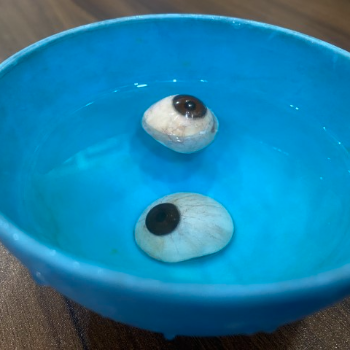 Hollow prosthesis Eyes | CARE TOUCH VISION CENTRE | 439B 202  MALIHABAD ROAD  THAKUR GANJ