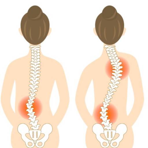Scoliosis Deformity Correction in Derawal Nagar | Improve Spinal Alignment ARCHIT GOYAL B 48 Ground Floor   Derawal Nagar DBA  Name The SpineSense ClinicLANDMARK Near Tata Showroom