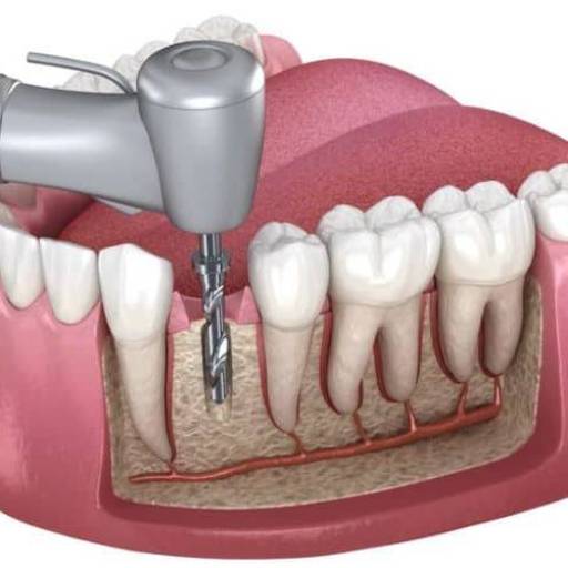 Teeth Pain Treatment in Indore | Fast Relief | DR DAGLIAS SAMBHAV CLINIC | 576 4 M G ROAD OPP  TI MALL BEHIND  PREMSHAN TIVILLA BUILDINGLANDMARK Behind Kalyan Jewellers MG Road