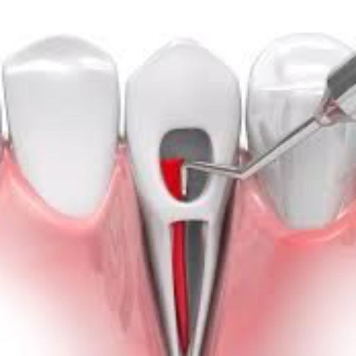 Root Canal Treatment in Koperkhairane | Advanced Dental Care | ASHA DENTALS CARE | SHREE BALAJI DOSANEAR SAMSUNG MOBILESHOP 5 MONALISA PLAZA KOPERKHAIRANE