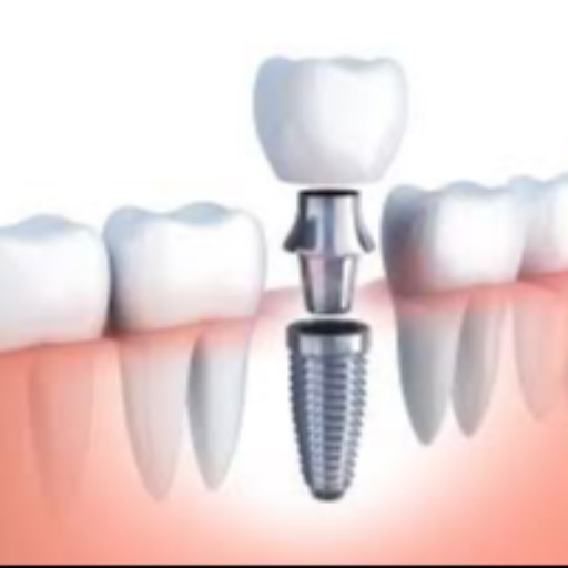 Tooth Implant in Koperkhairane | Permanent Smile Restoration | ASHA DENTALS CARE | SHREE BALAJI DOSANEAR SAMSUNG MOBILESHOP 5 MONALISA PLAZA KOPERKHAIRANE