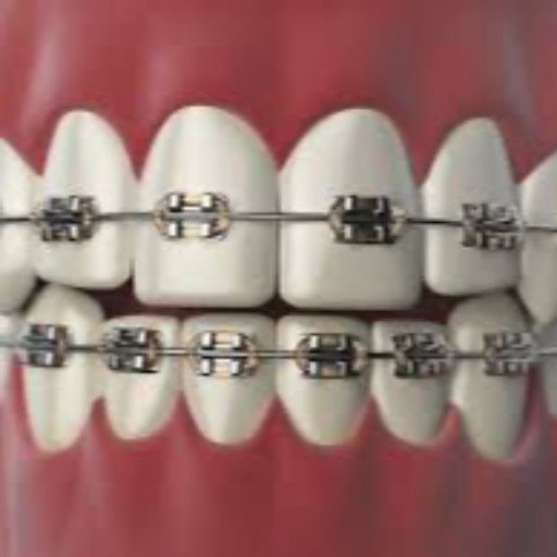 Orthodontic ( Braces) | ASHA DENTALS CARE | SHREE BALAJI DOSANEAR SAMSUNG MOBILESHOP 5 MONALISA PLAZA KOPERKHAIRANE