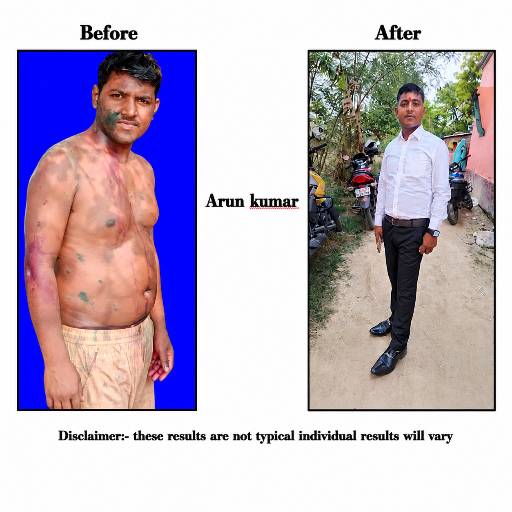 Skin Transformation Service in Patna | Radiant Skin at RUBY RANJAN, PATNA