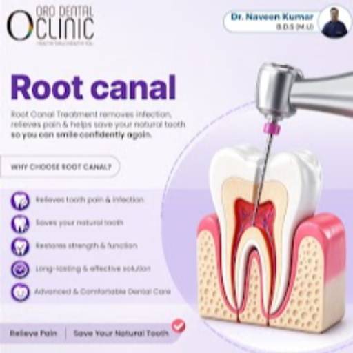 Root Canal Dental Service in Oro Dental Clinic | Expert