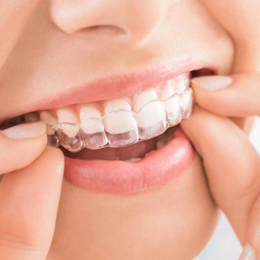 RISHABH RAMESH PENDURKAR - Invisalign in MUMBAI — RISHABH RAMESH PENDURKAR in MUMBAI