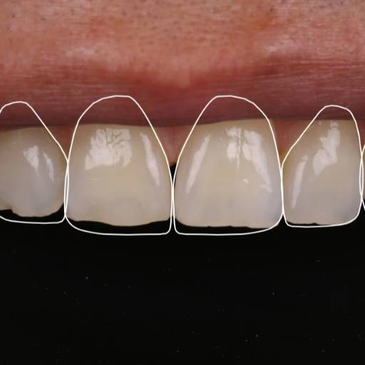 RISHABH RAMESH PENDURKAR - Smile Design and Veneer in Mumbai | Artistic Smile in MUMBAI