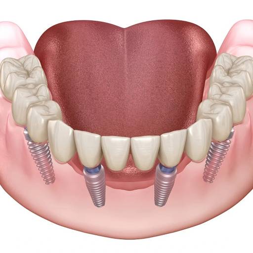 RISHABH RAMESH PENDURKAR - Dental Implants in Mumbai | Comprehensive Restorative in MUMBAI